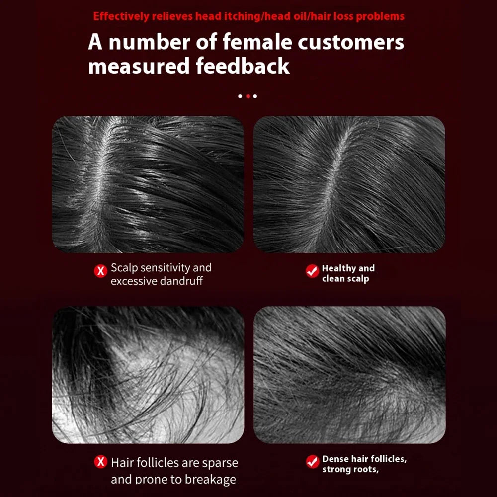 Electric Scalp Massager with Red Light Therapy